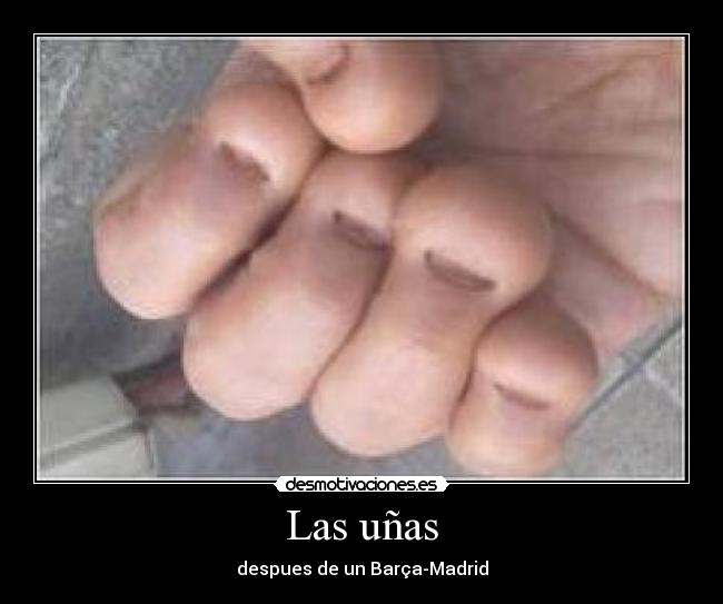Las uñas - despues de un Barça-Madrid