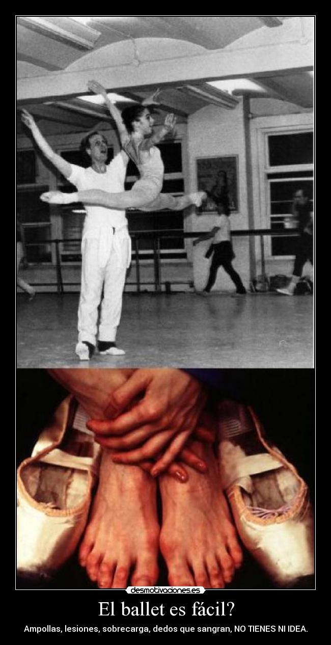 El ballet es fácil? -
