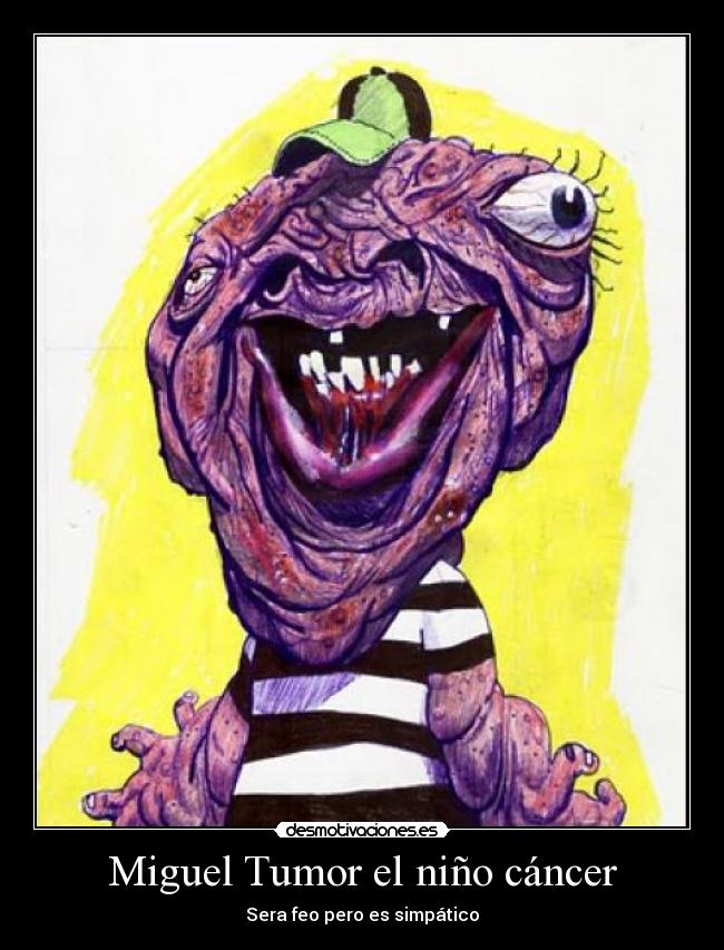 Miguel Tumor el niño cáncer - Sera feo pero es simpático