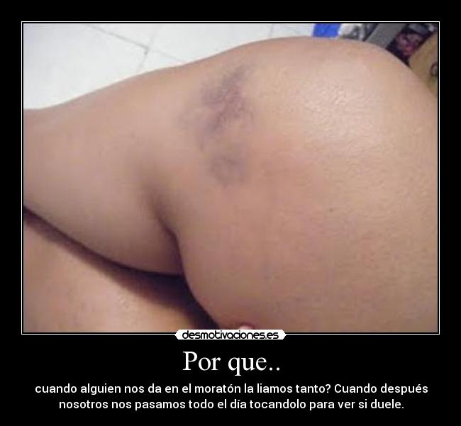 Por que.. - cuando alguien nos da en el moratón la liamos tanto? Cuando después
nosotros nos pasamos todo el día tocandolo para ver si duele.