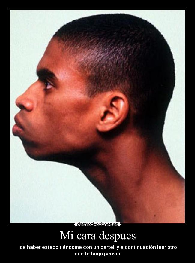 Mi cara despues -
