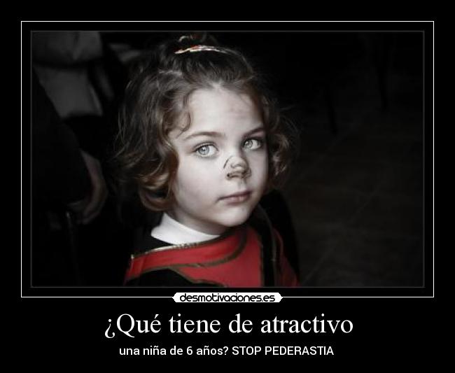¿Qué tiene de atractivo - 