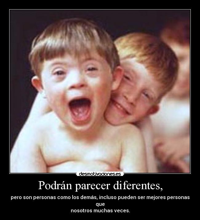 Podrán parecer diferentes, - pero son personas como los demás, incluso pueden ser mejores personas que
nosotros muchas veces.