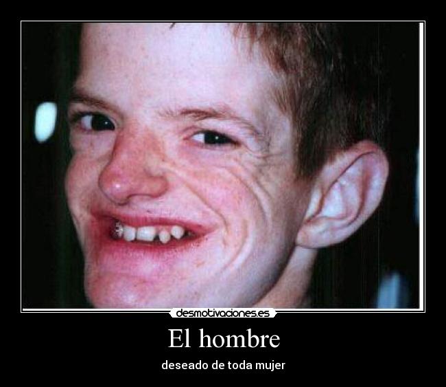 El hombre -