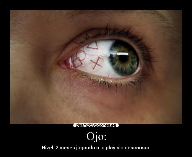 Ojo: - Nivel: 2 meses jugando a la play sin descansar.