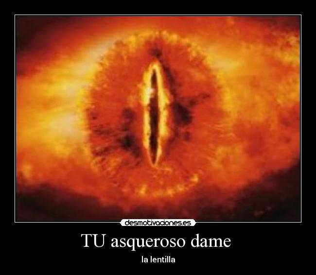 TU asqueroso dame  - la lentilla