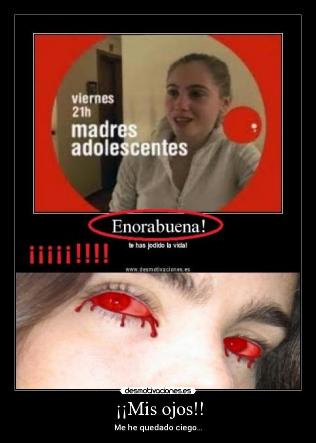 ¡¡Mis ojos!! - Me he quedado ciego...