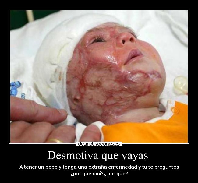 Desmotiva que vayas -