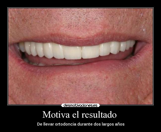 Motiva el resultado  - 