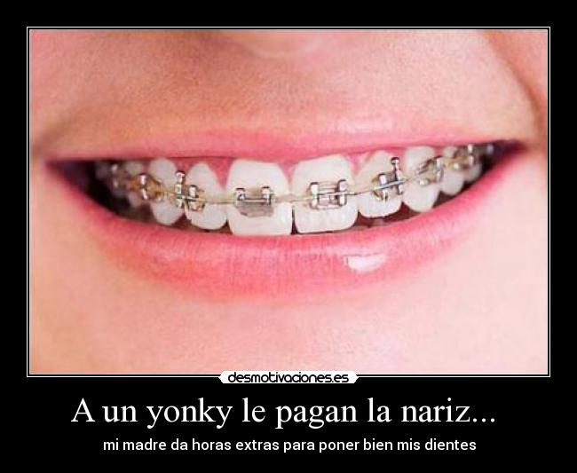 A un yonky le pagan la nariz... -