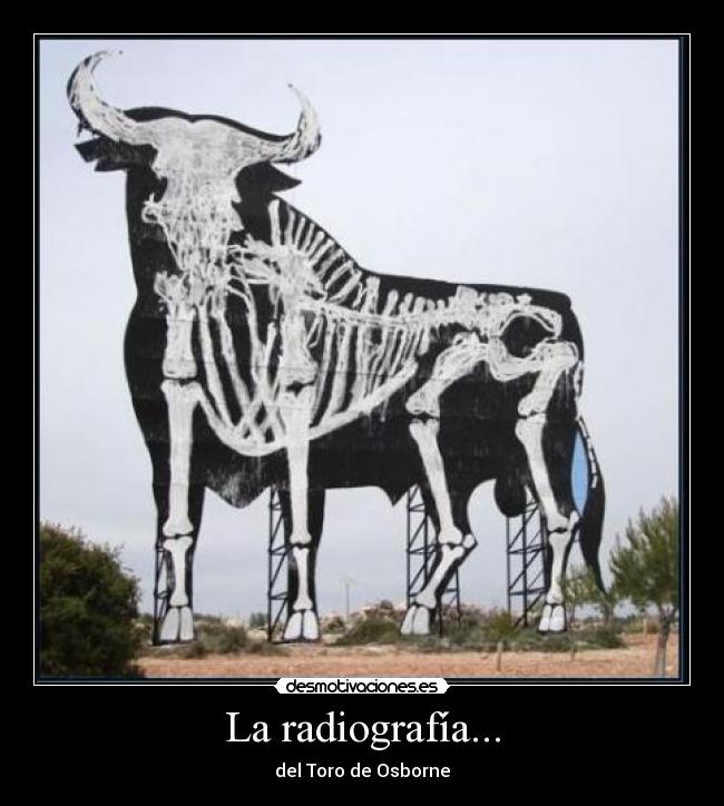 La radiografía... - 