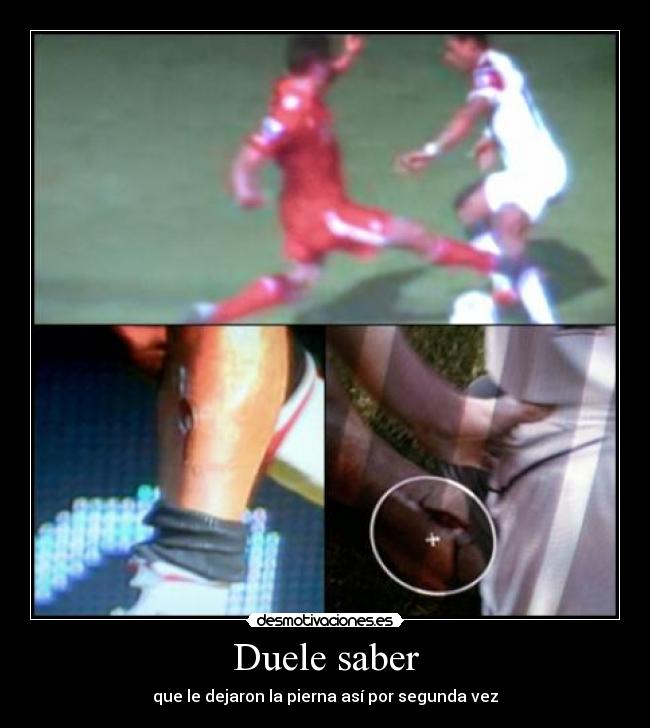 Duele saber -
