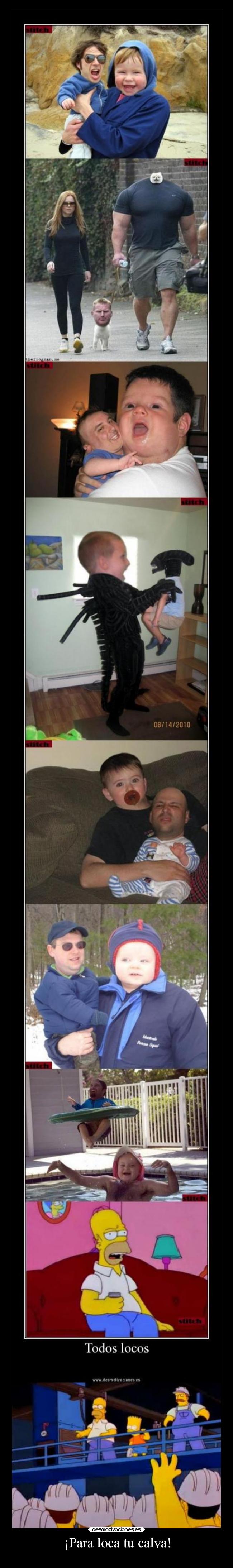 ¡Para loca tu calva! - 