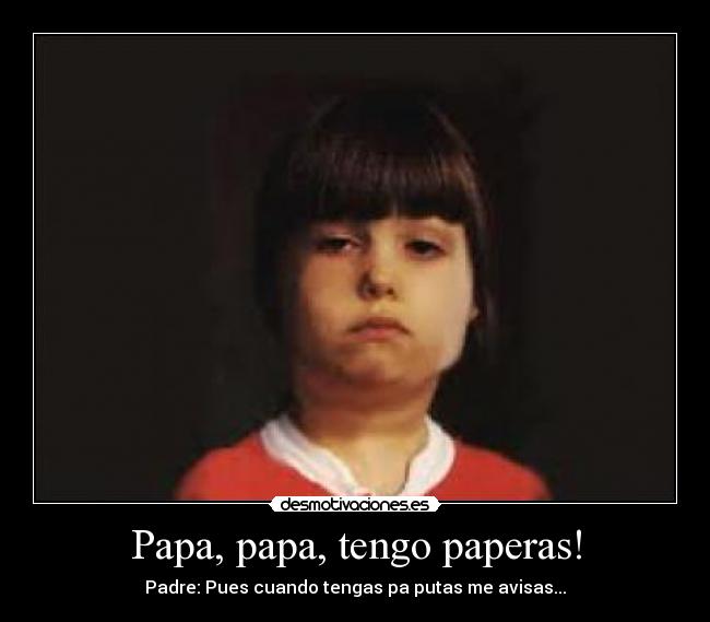 Papa, papa, tengo paperas! - Padre: Pues cuando tengas pa putas me avisas...
