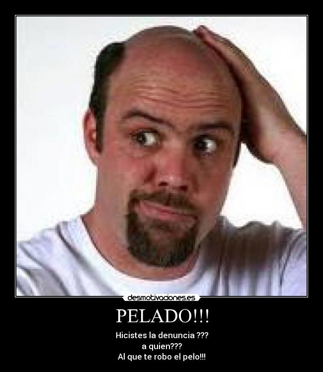 PELADO!!! - Hicistes la denuncia ???
a quien???
Al que te robo el pelo!!!