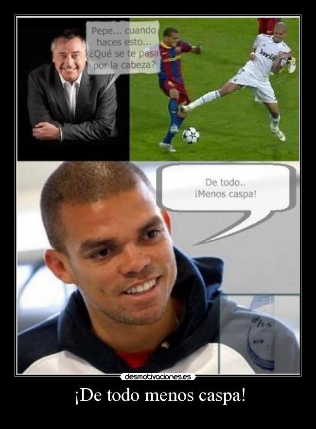 ¡De todo menos caspa! -