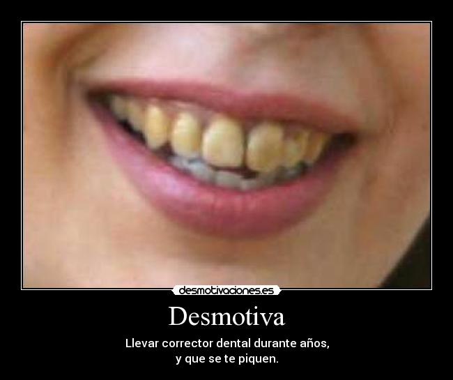 Desmotiva - Llevar corrector dental durante años,
y que se te piquen.