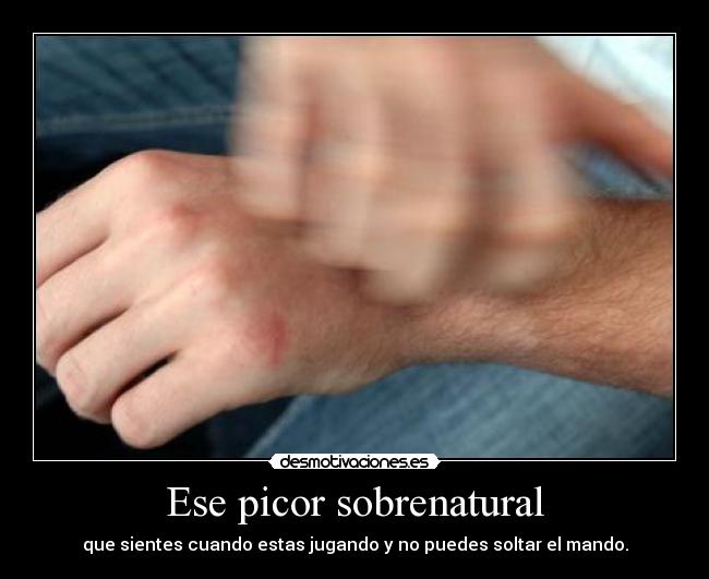 Ese picor sobrenatural - 