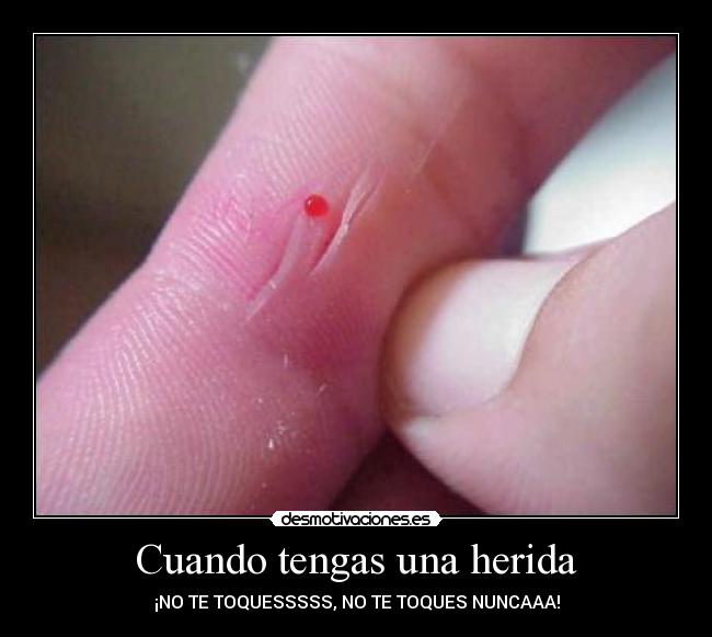 Cuando tengas una herida -