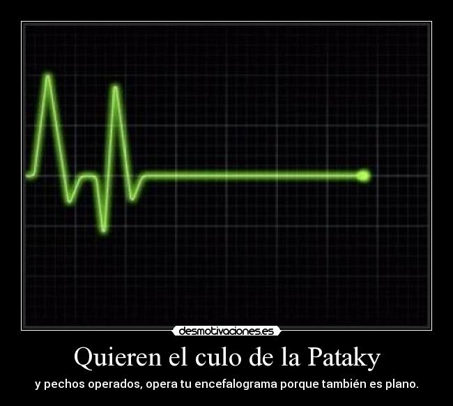 Quieren el culo de la Pataky - 