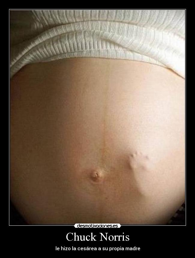 Chuck Norris - le hizo la cesárea a su propia madre