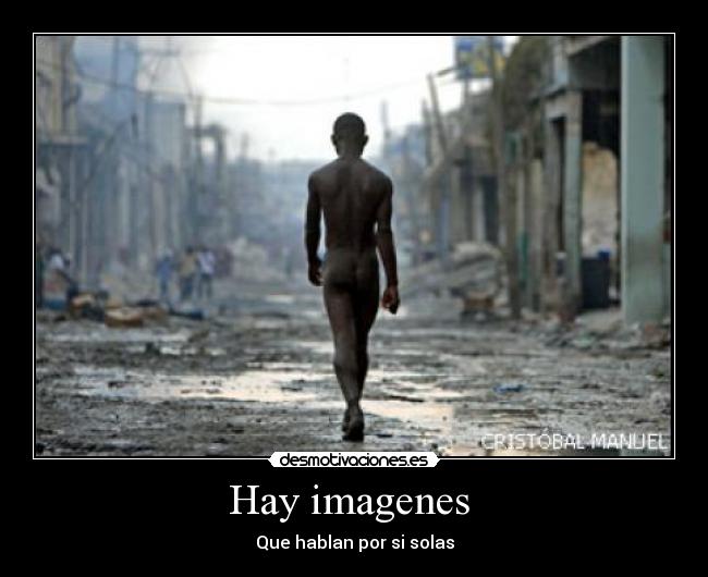 Hay imagenes  - 