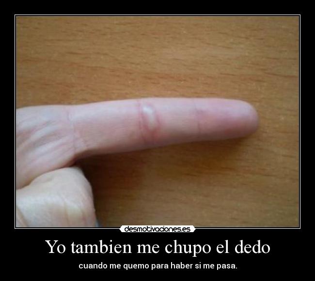 Yo tambien me chupo el dedo - cuando me quemo para haber si me pasa.