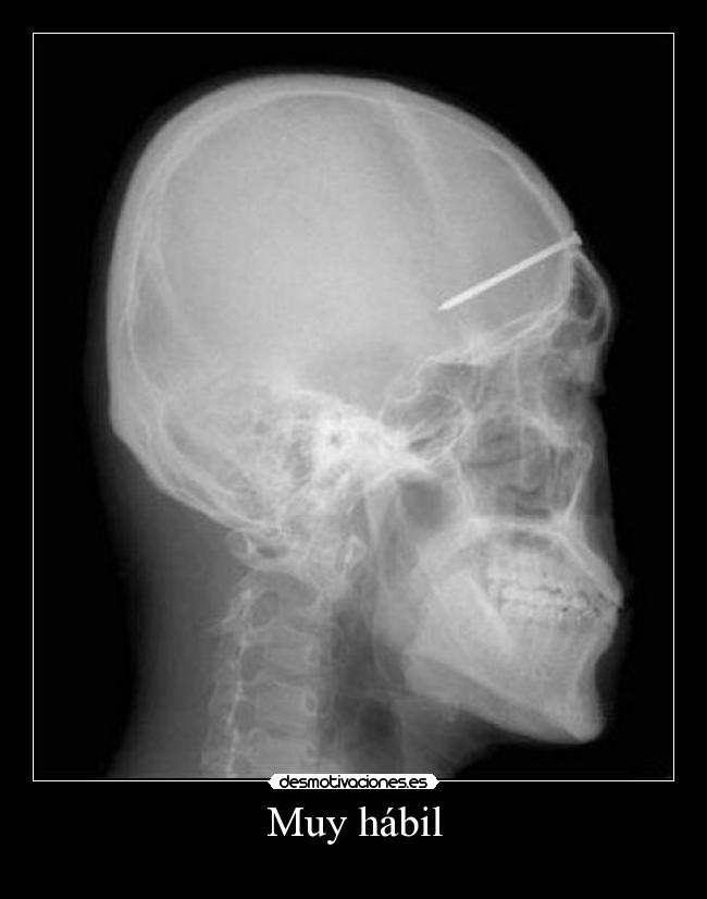 Muy hábil - 