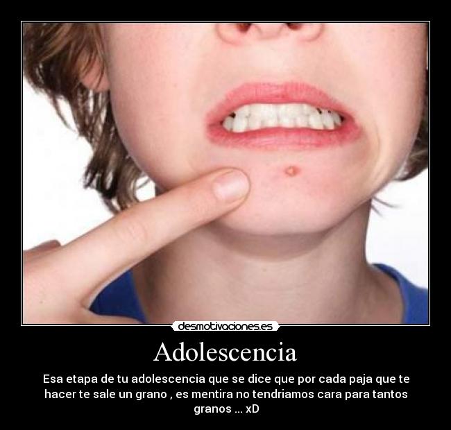 Adolescencia -