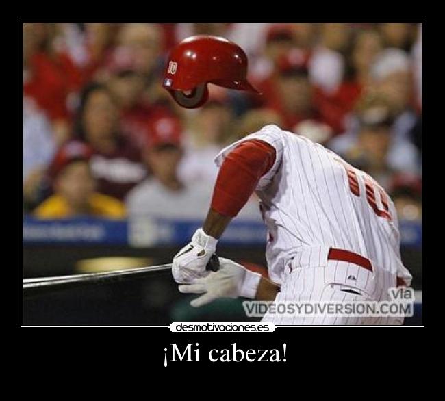 ¡Mi cabeza! -