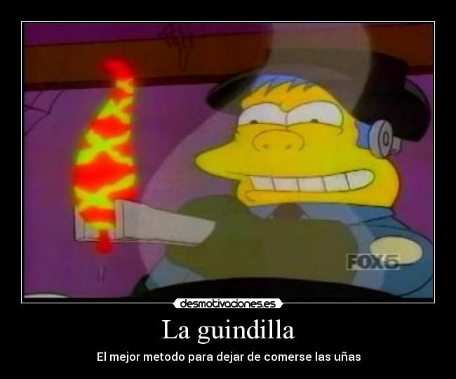 La guindilla - El mejor metodo para dejar de comerse las uñas