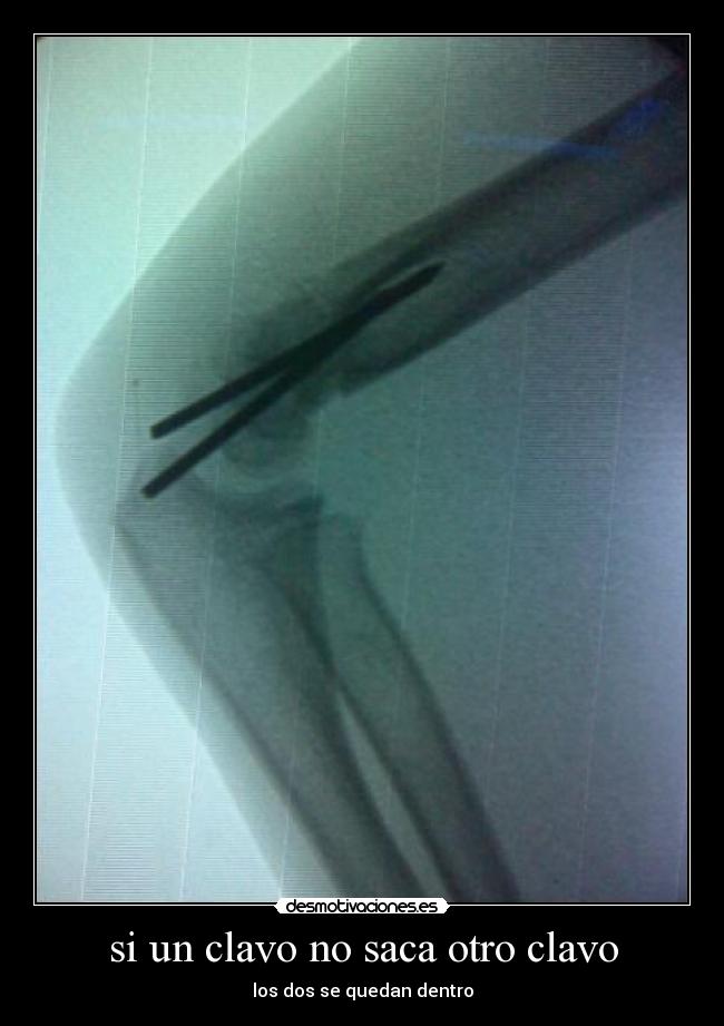 carteles clavo desmotivaciones