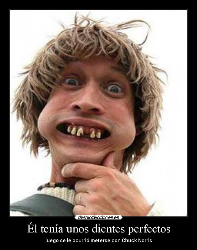 Él tenía unos dientes perfectos - luego se le ocurrió meterse con Chuck Norris