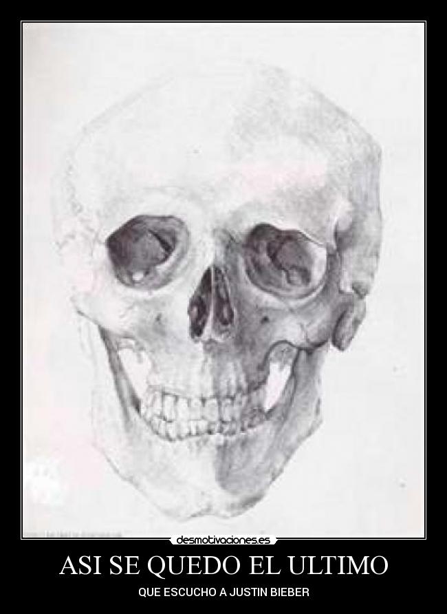 ASI SE QUEDO EL ULTIMO - 
