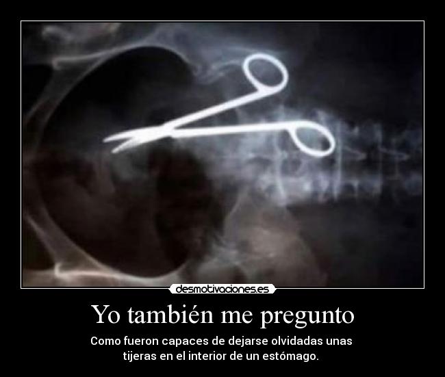 Yo también me pregunto - Como fueron capaces de dejarse olvidadas unas 
tijeras en el interior de un estómago. 