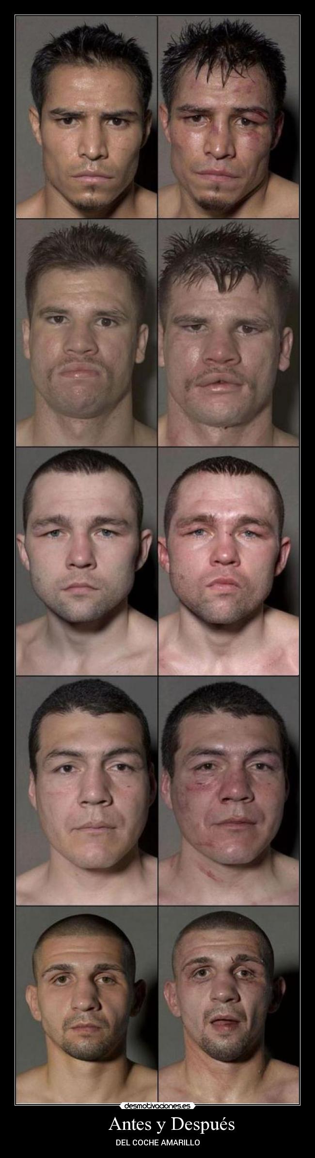       Antes y Después - 