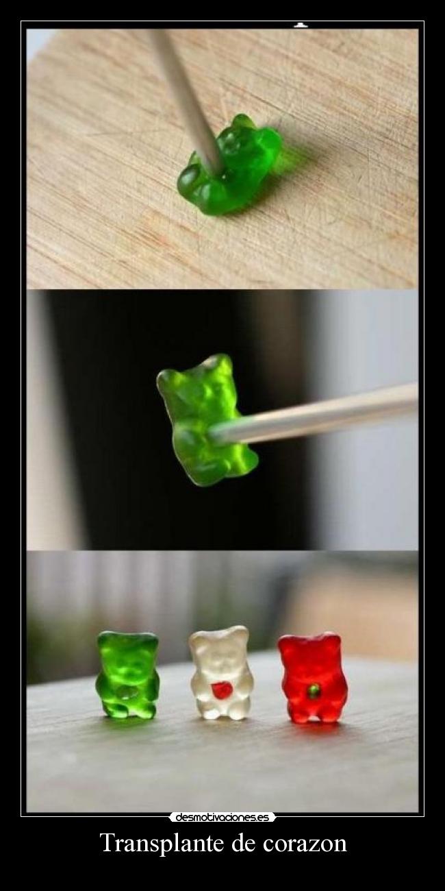 Transplante de corazon -
