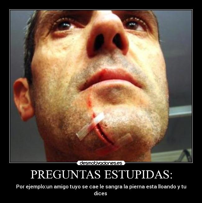 PREGUNTAS ESTUPIDAS: - Por ejemplo:un amigo tuyo se cae le sangra la pierna esta lloando y tu dices