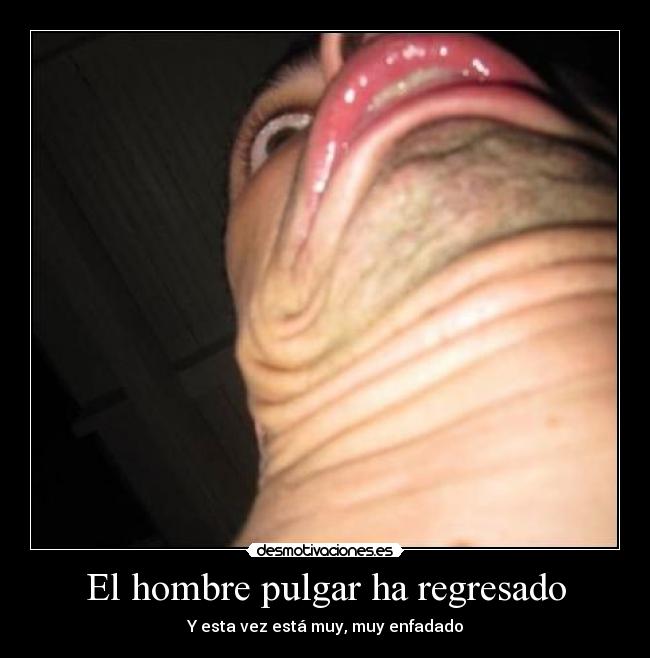 El hombre pulgar ha regresado - 