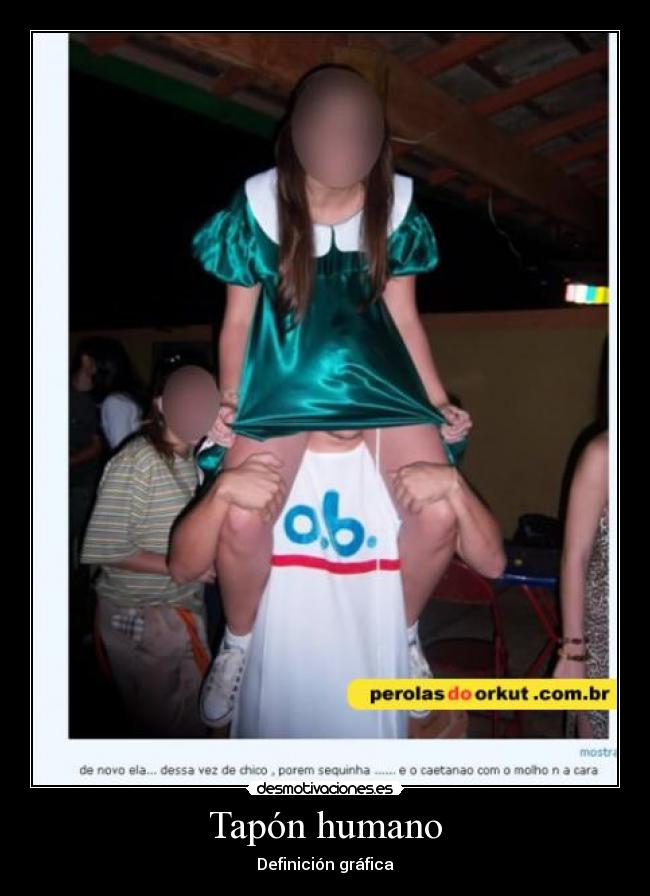 Tapón humano - Definición gráfica