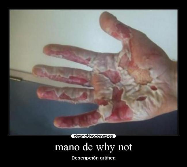 mano de why not -