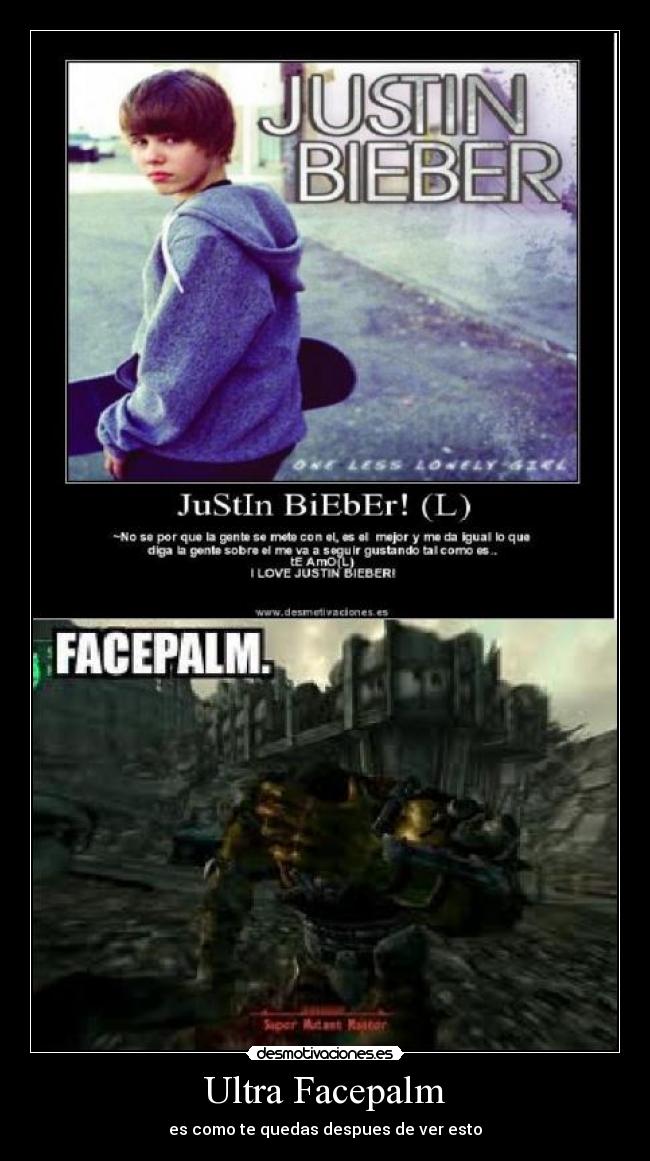 Ultra Facepalm - es como te quedas despues de ver esto