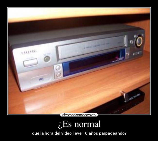 ¿Es normal - 