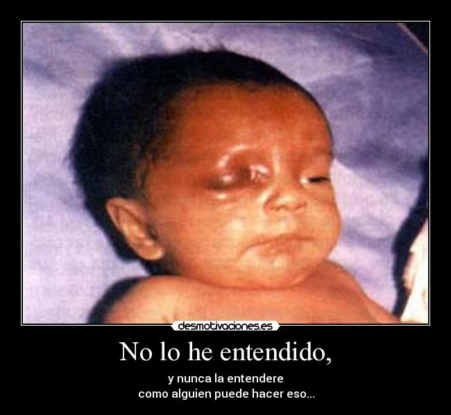 No lo he entendido, - 