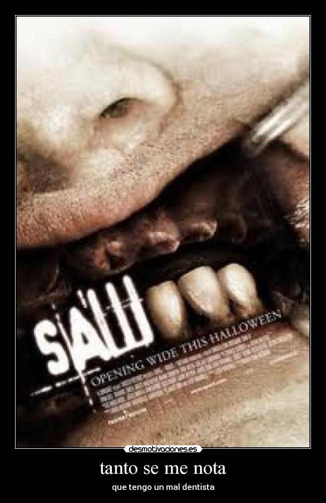 tanto se me nota - que tengo un mal dentista