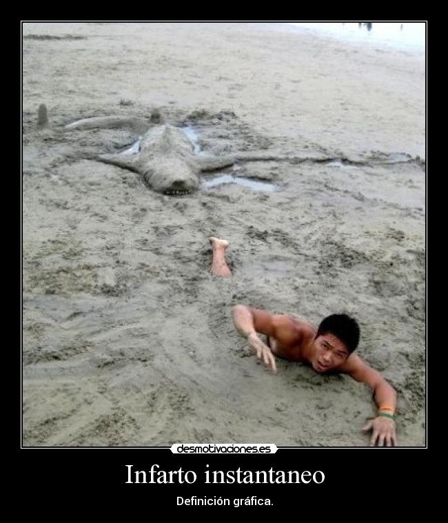 Infarto instantaneo -