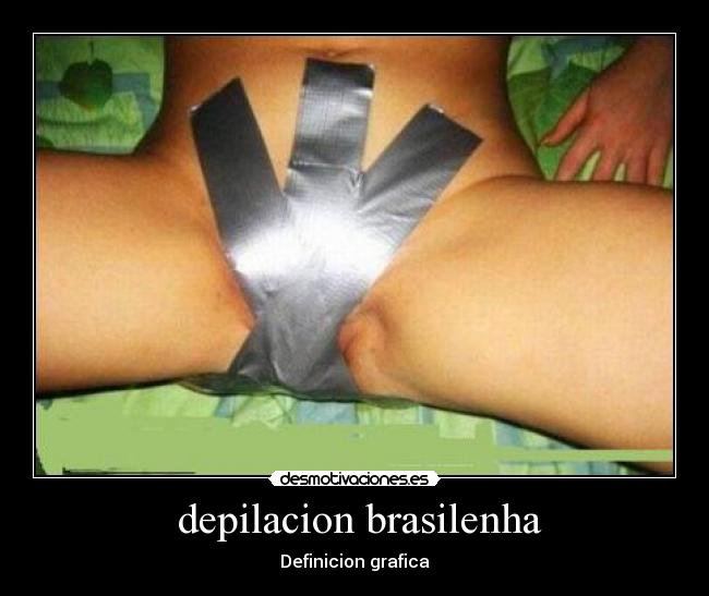 depilacion brasilenha -