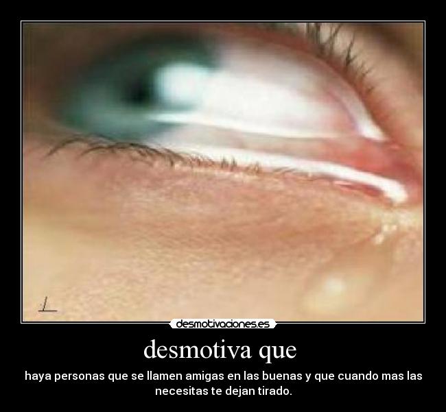 desmotiva que -