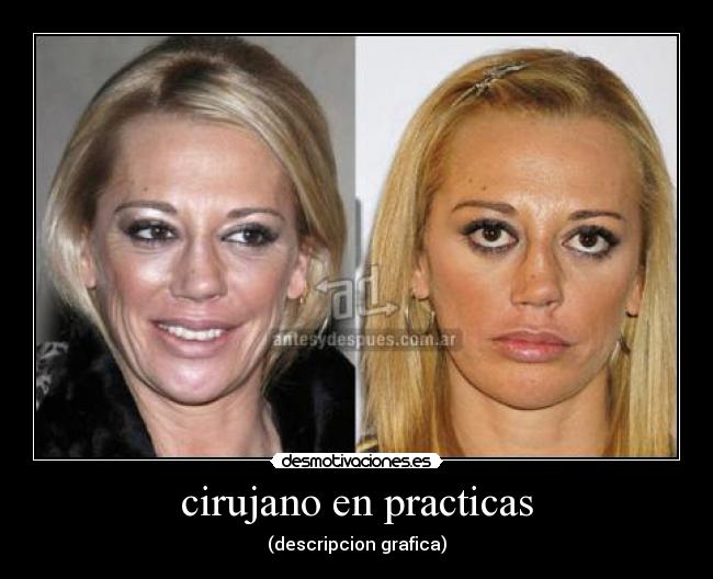 cirujano en practicas - 