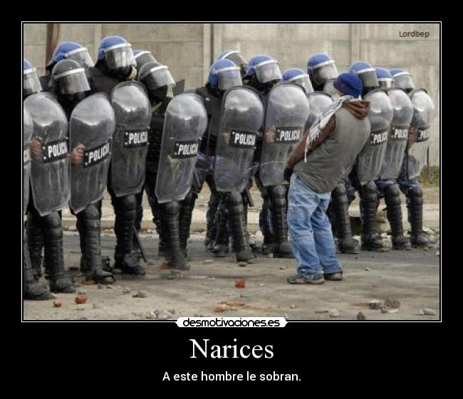 Narices - 
